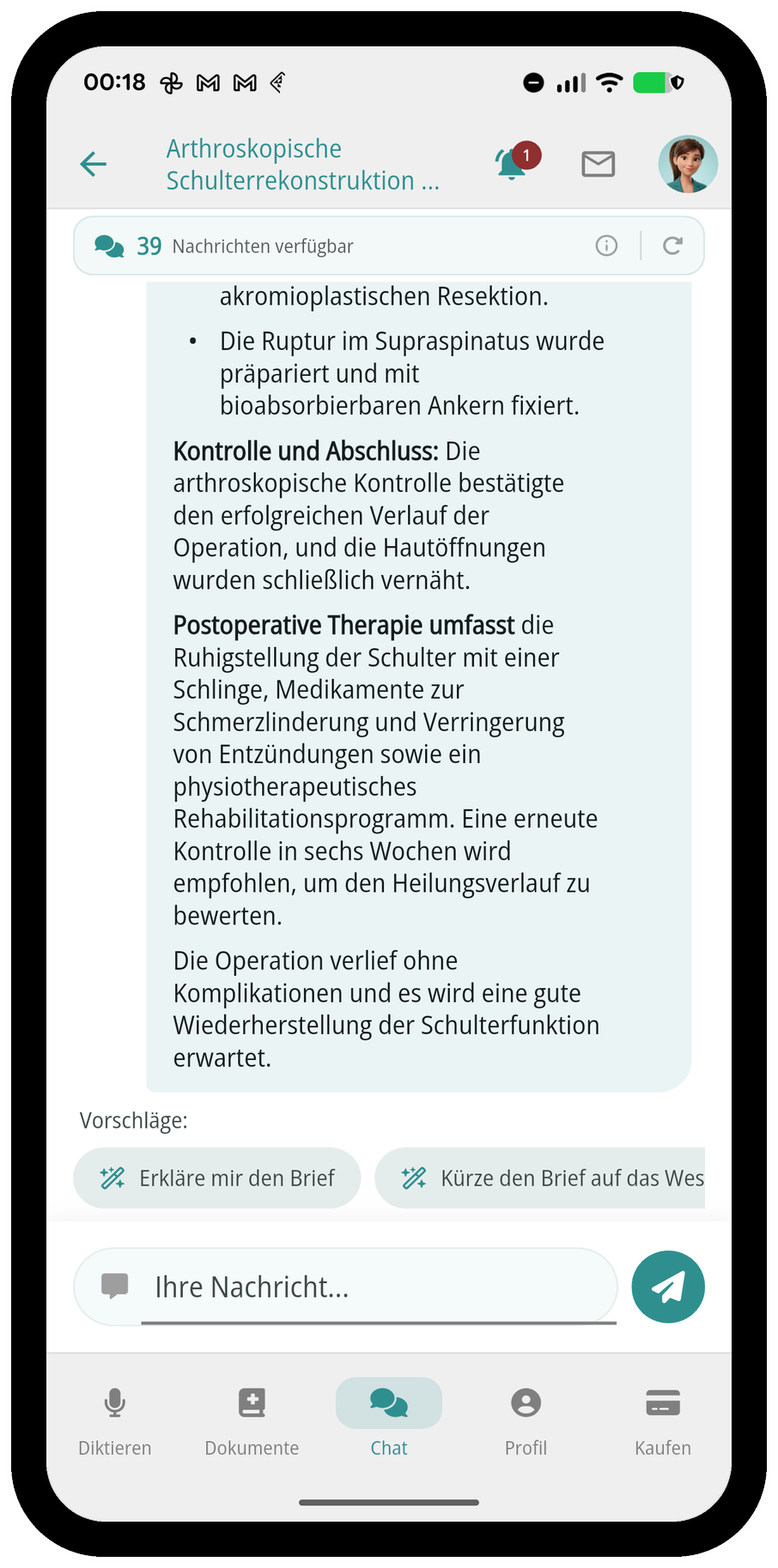 Chat mit dem Dokument